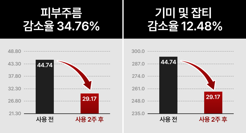 눈가팔자주름