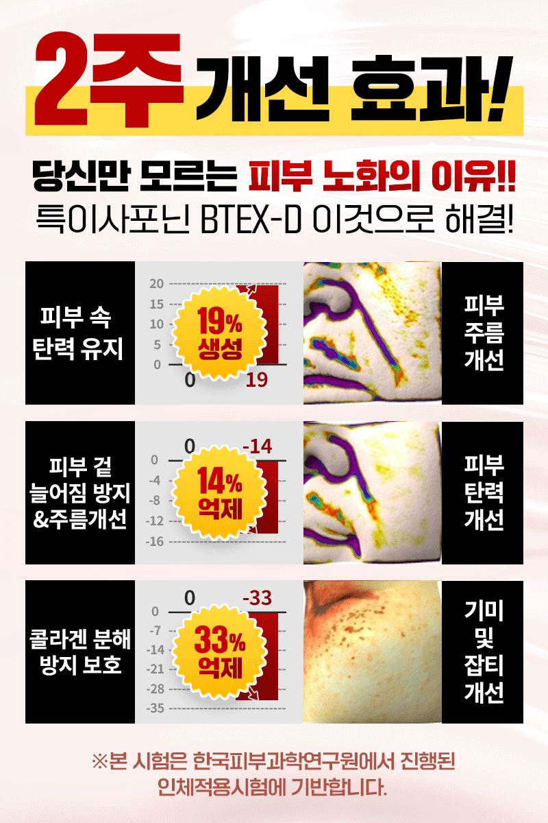 기미 및 색소침착